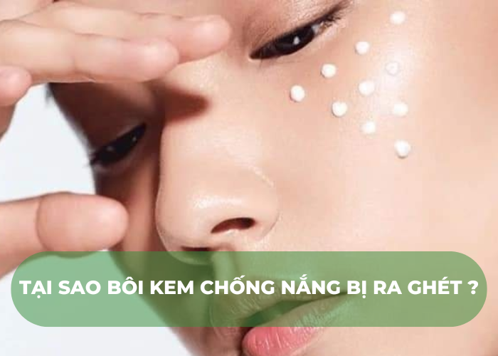 Tại sao bôi kem chống nắng bị ra ghét?